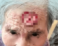 太狠了!98岁阿婆拿起剪刀,对准自已一刀下去…后果很严重!