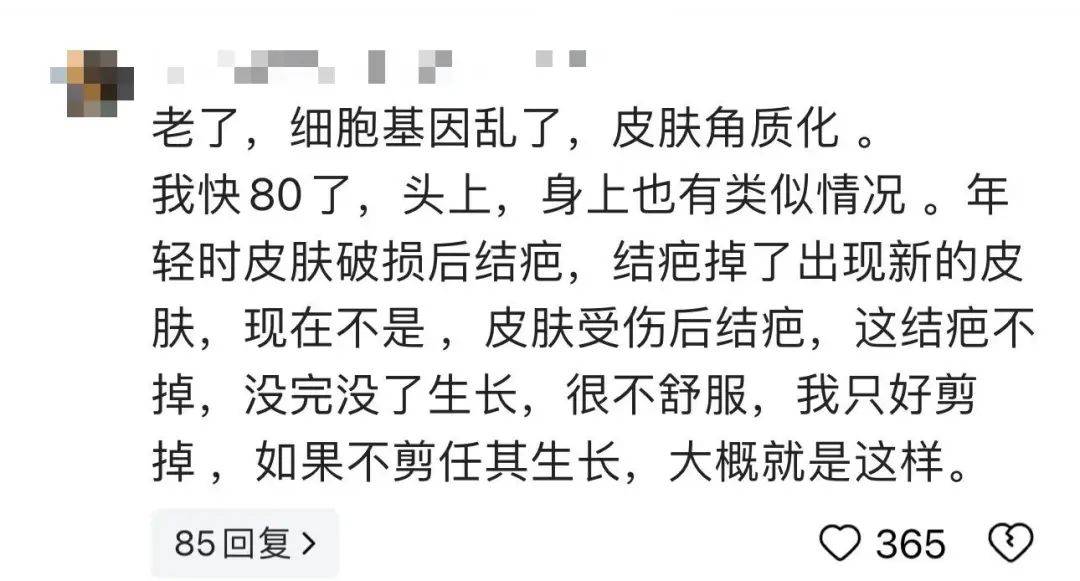 太狠了!98岁阿婆拿起剪刀,对准自已一刀下去…后果很严重!