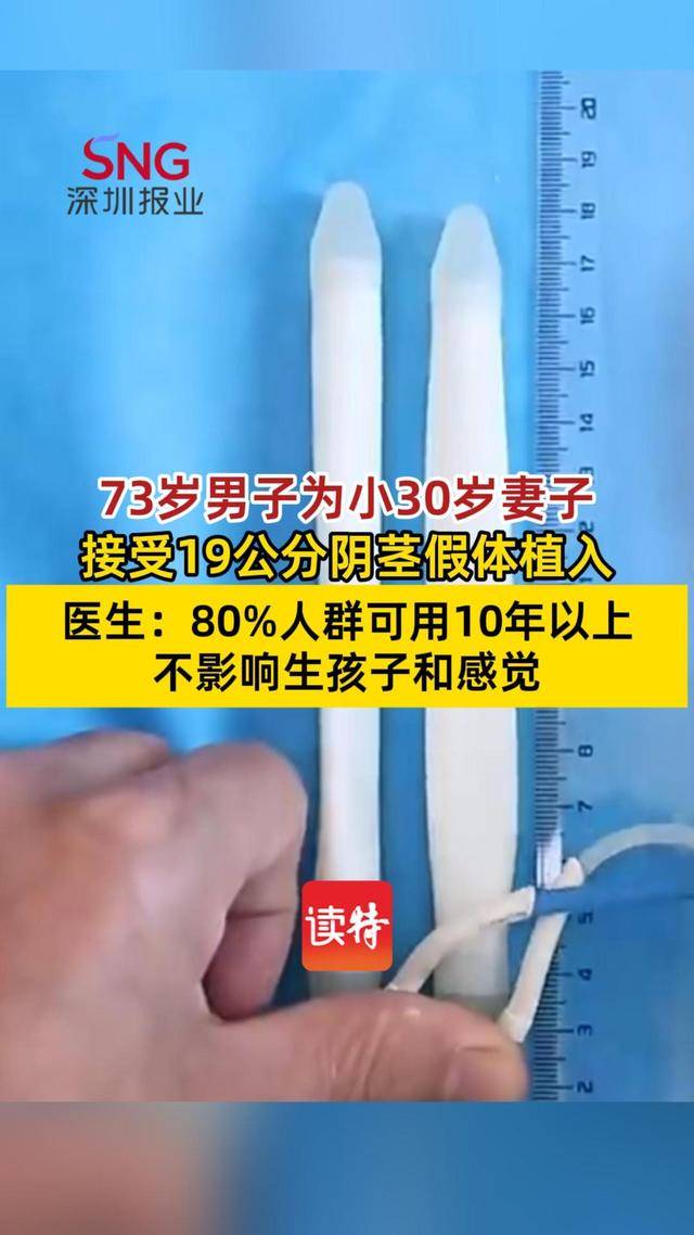 73岁男子为小30岁妻子植入19公分阴茎假体，医生：80%人群可用10年以上